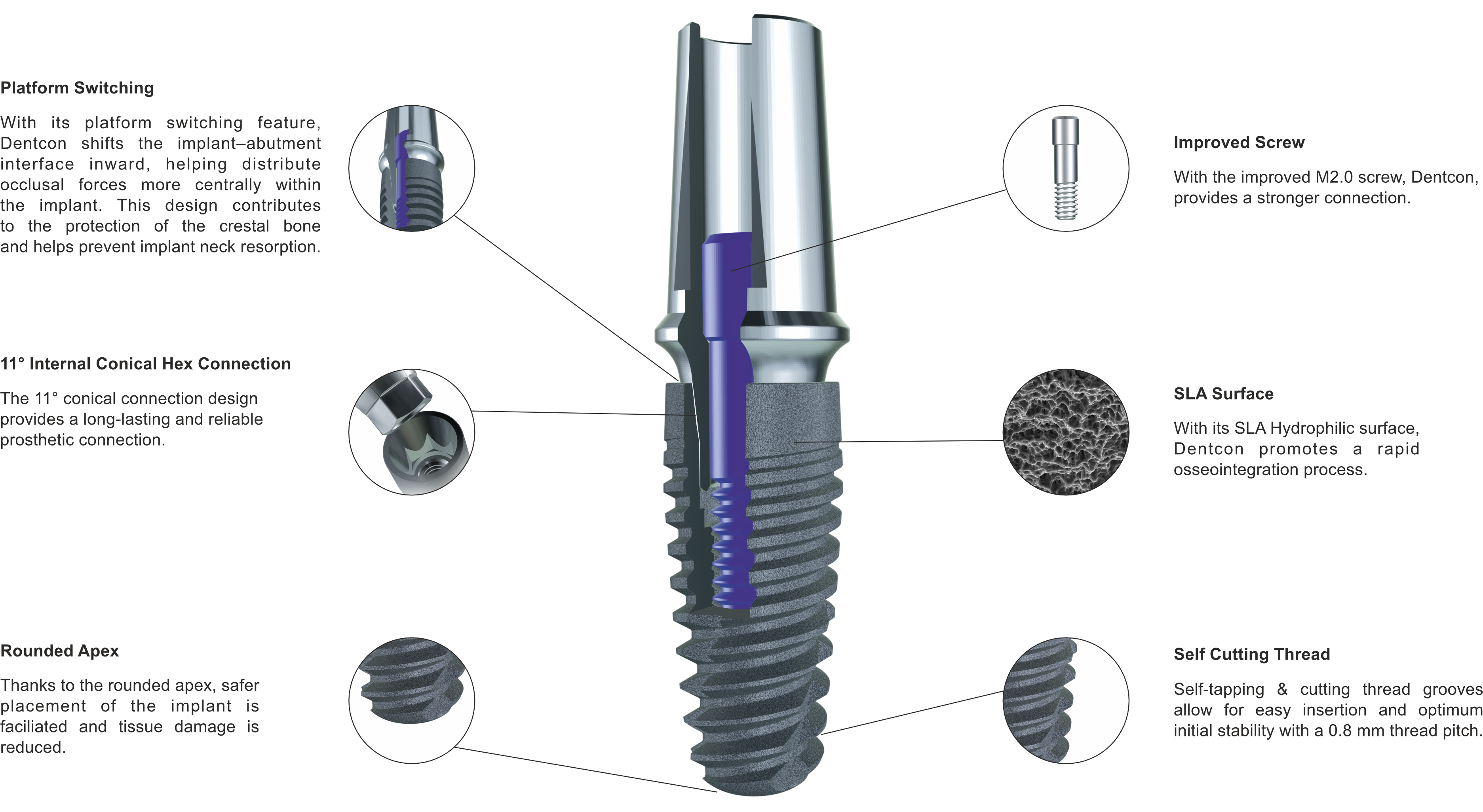 Dentcon Features