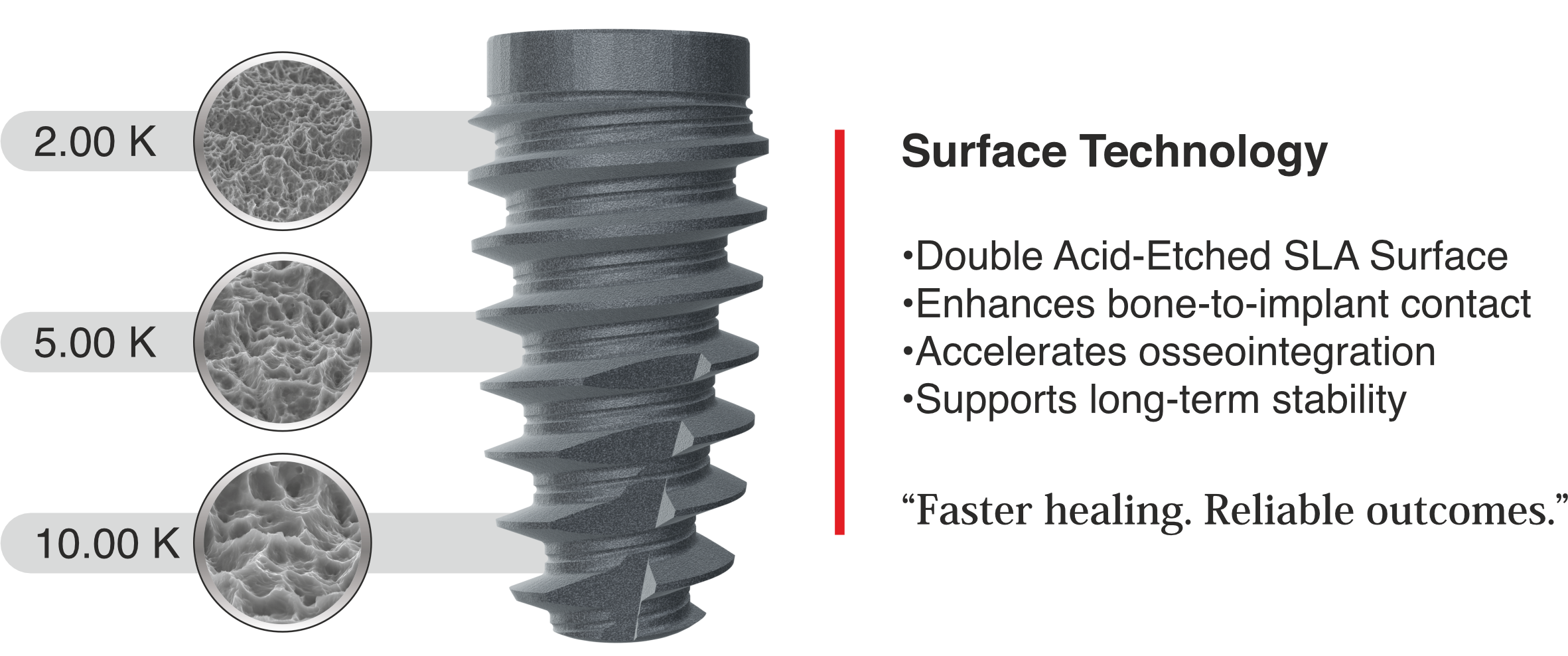 Surface Technology